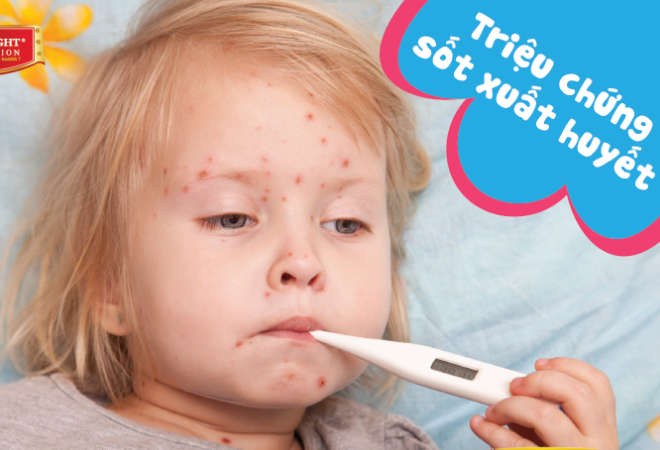 Triệu chứng sốt xuất huyết ở trẻ