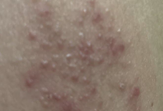 Mua hồ nước chữa zonan thần kinh ở đâu